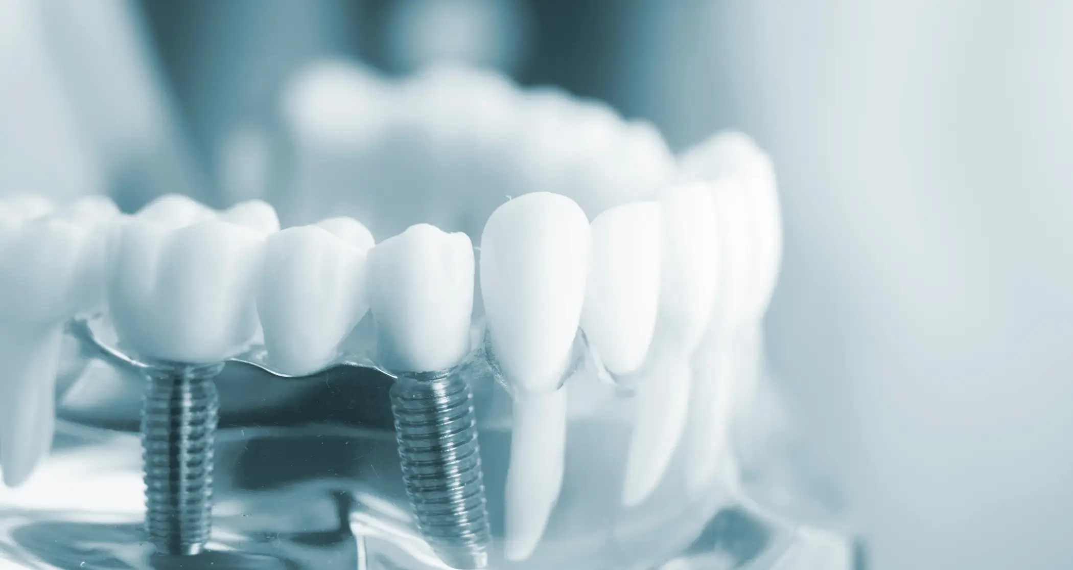 A szájegészség globális jövője – Trendek, kihívások és megoldások az FDI nemzetközi kutatásai alapján